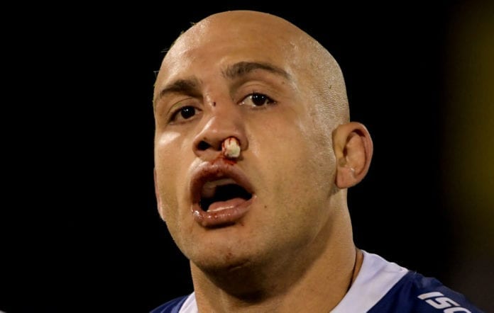 NRL Rd 5 - Raiders v Eels